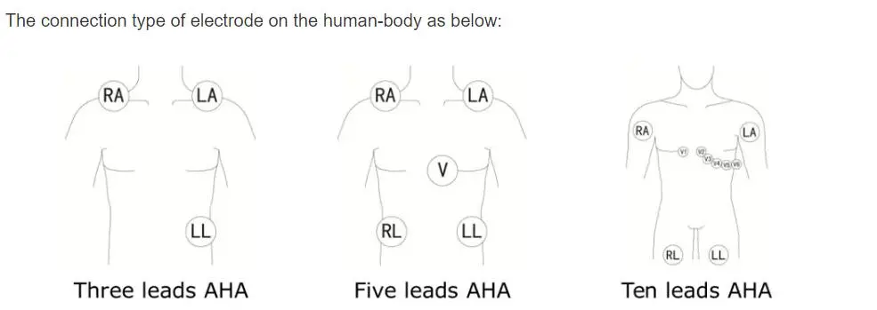 5-Lead EKG-ledninger til philips digitrak plus 24 timers holter 3100A, 5-lead, Snap